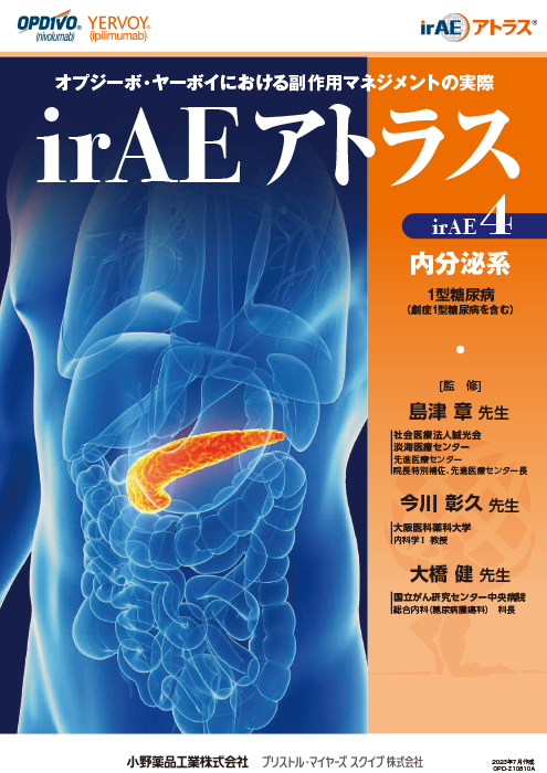 内分泌系 1型糖尿病