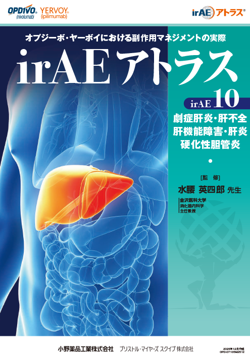 劇症肝炎・肝不全・肝機能障害・肝炎・硬化性胆管炎